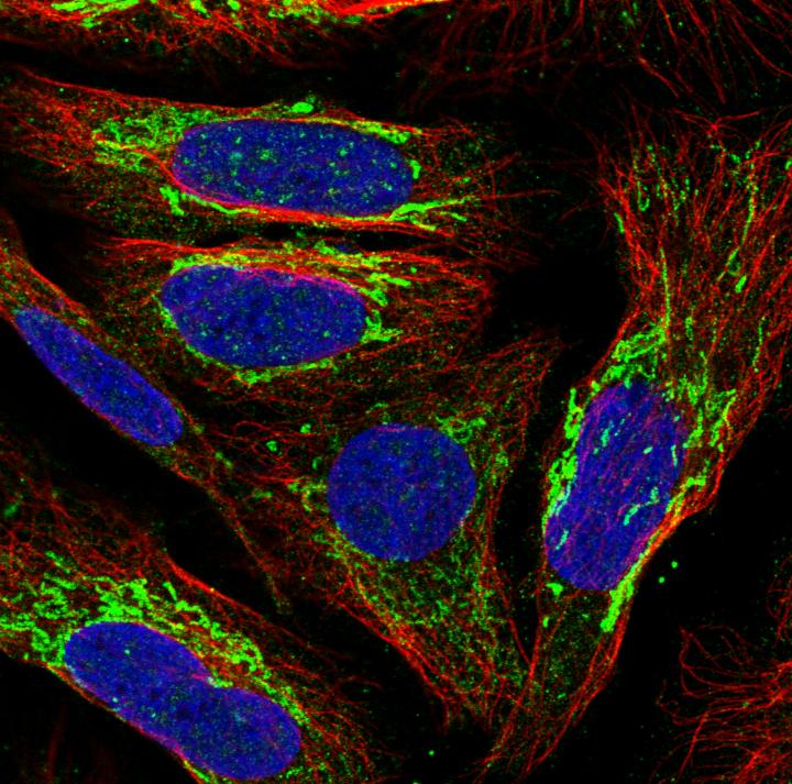 New Map Tracks Protein Expression in Human Tissues (6 of 8)