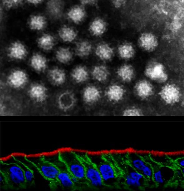 Electron Micrograph