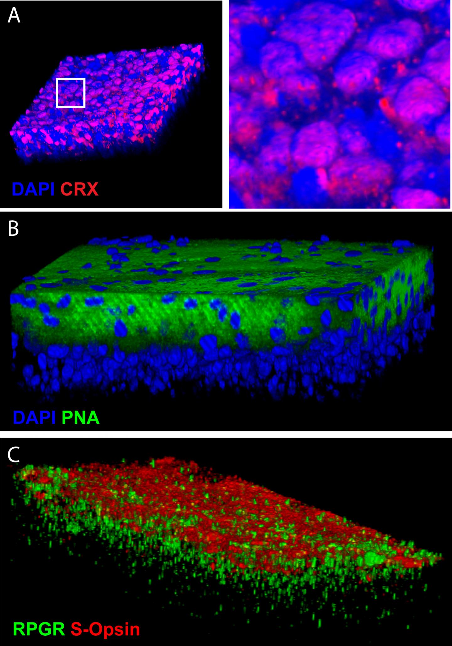 Restoring Vision with Stem Cells (2 of 2)