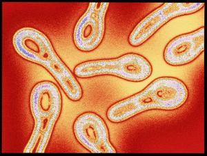 	Diphtheria is a rare disease in the EU/EEA thanks to the safe and effective vaccines