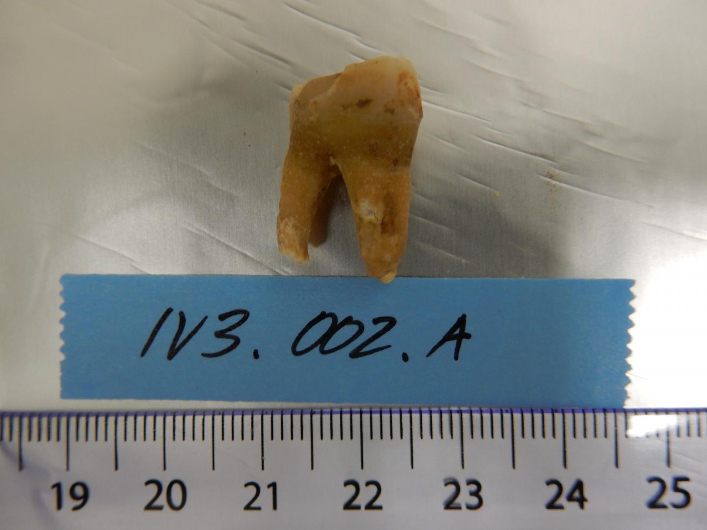 Tooth