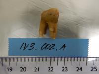 Tooth