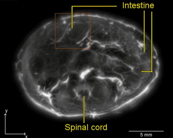 Intestines in Real-Time