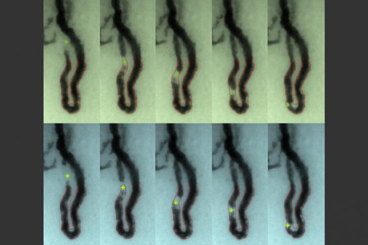 Monitor Detects Dangerously Low White Blood Cell Levels