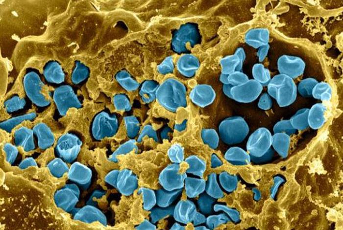 <I>Francisella</I>