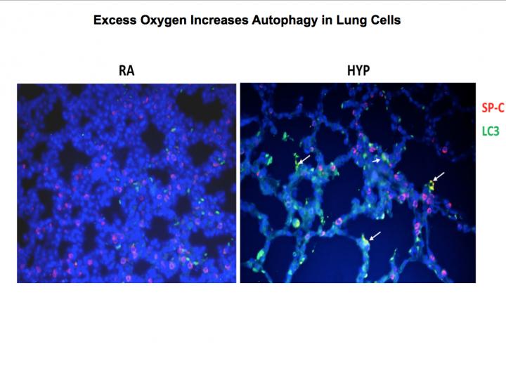 Excess Oxygen Increases Autophagy in Lung Cells