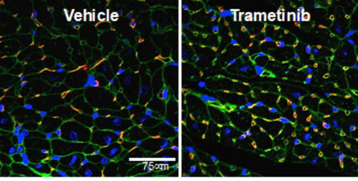 Heart tissue