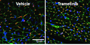 Heart tissue