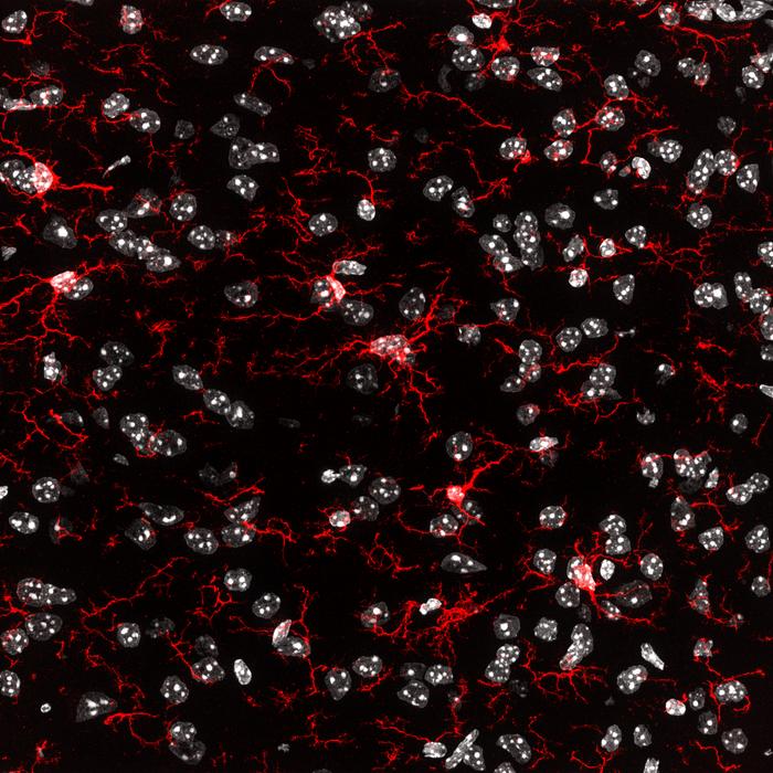 Microglia in a brain tissue sample