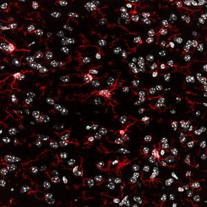 Microglia in a brain tissue sample