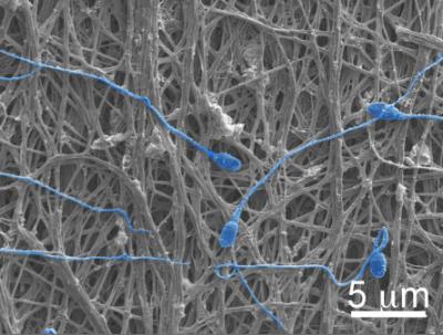 Fibers and Sperm