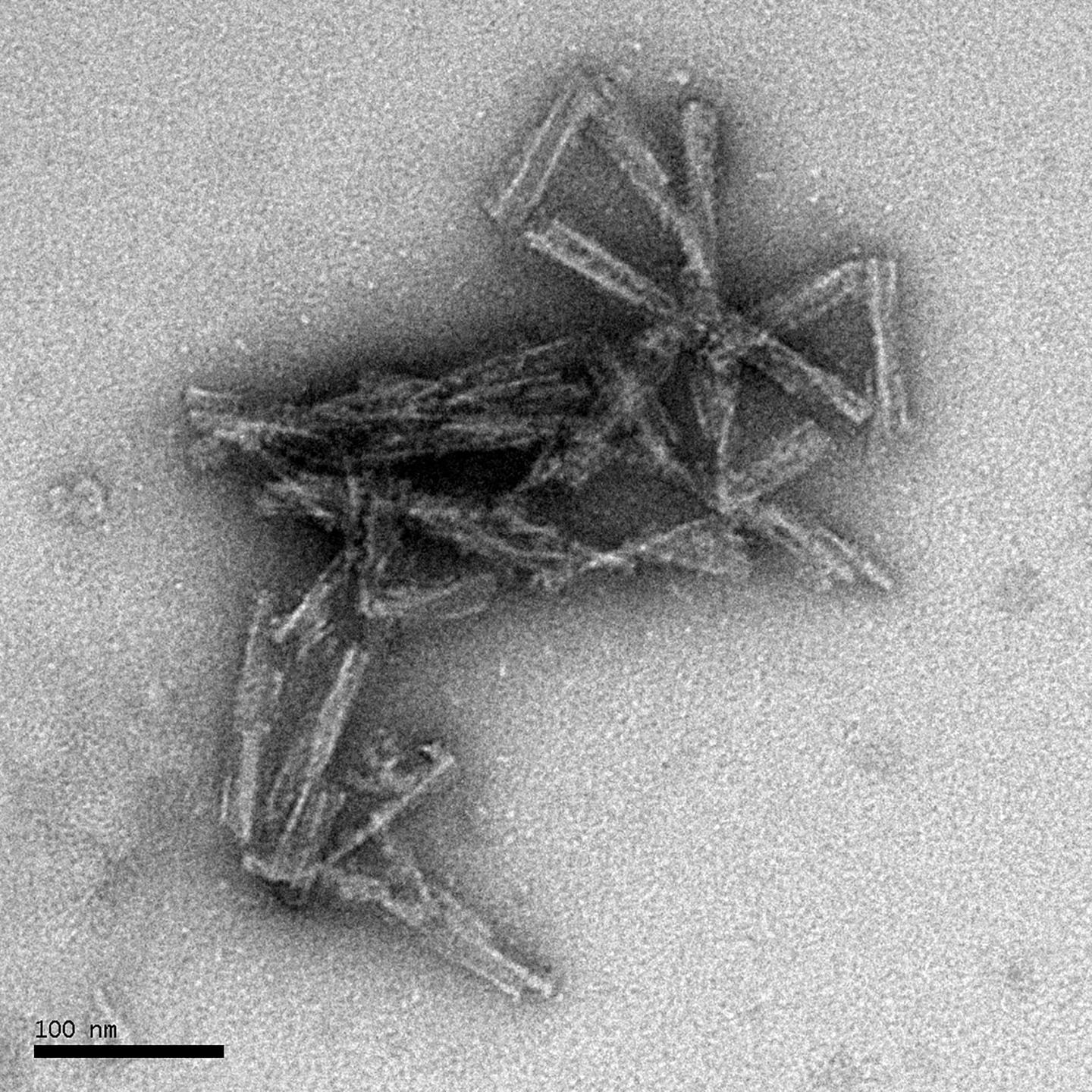 Purified Infectious Prion Rods