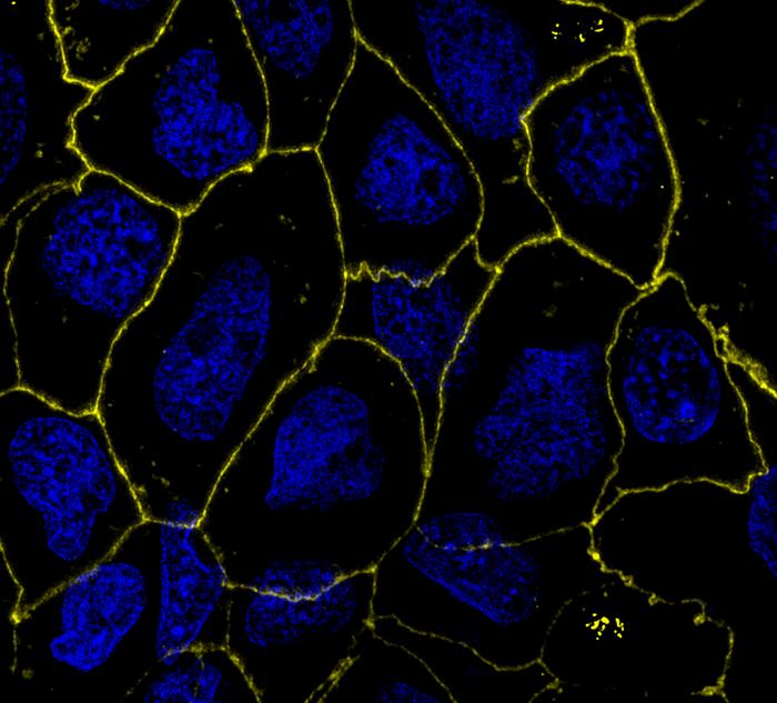 Repaired Gut Epithelium
