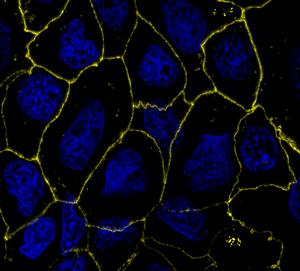 Repaired Gut Epithelium