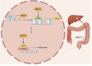Schematic diagram illustrating OXCT11 in colorectal cancer