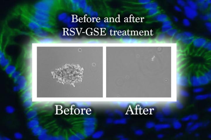 Cancer Stem Cell 