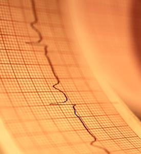 EKG Photo