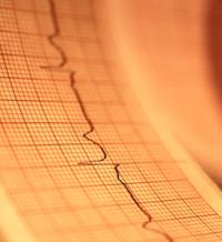 EKG Photo