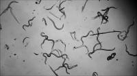 Hook Worm <i>Necator Americanus</i> 2