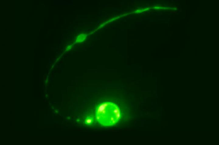 Cell Death
