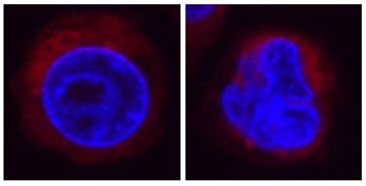 Fluorescence Microscopy Image of HL-60 cells