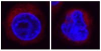 Fluorescence Microscopy Image of HL-60 cells