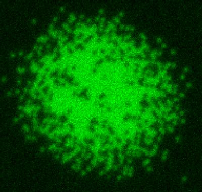 Ultracold Atoms Imaged Using Quantum Gas Microscope