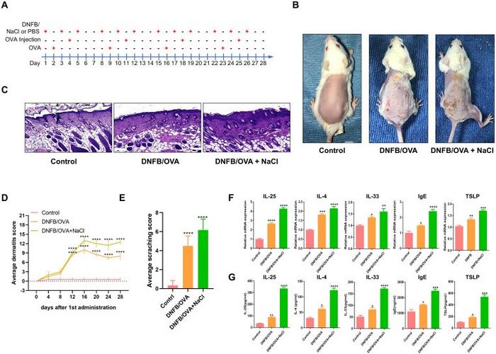 The high-salt microenvironment promotes disease development in mice with DNCB/OVA-induced atopic dermatitis.