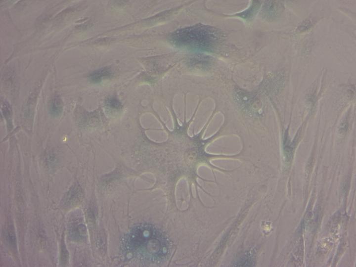 Senescence in Human Cells
