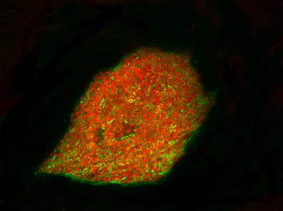 Human Embryonic Stem Cells