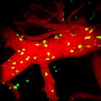 Immune System Cells Cause Severe Malaria Complication in Mouse Brain