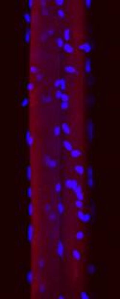 Confocal Microscopy