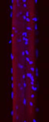 Confocal Microscopy