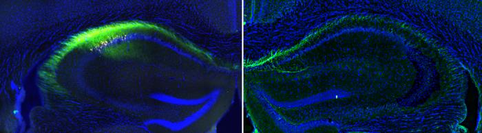 A study by the Institute for Neurosciences identifies a key brain circuit for spatial memory