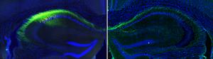 A study by the Institute for Neurosciences identifies a key brain circuit for spatial memory