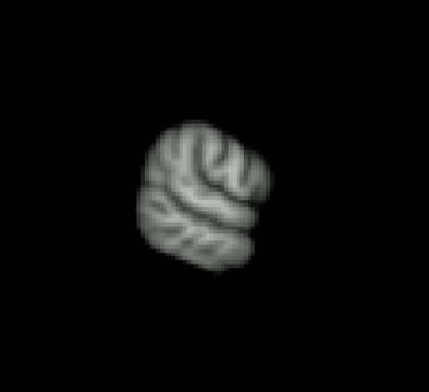 Brain Activity