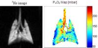 Penn -- New Lung Imaging Techniques