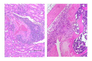 New Spontaneous Mouse Model Shows Promise for Bolstering Sjögren's Syndrome Treatment