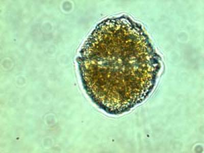 Lingulodinium polyedrum