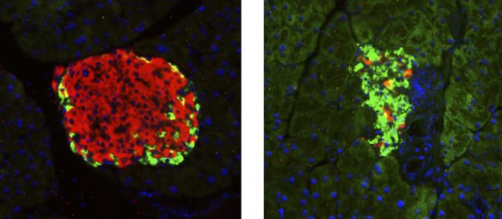 Pancreatic Islet
