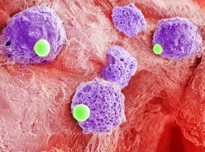 Two-Cells-In-One Leukemia Treatment