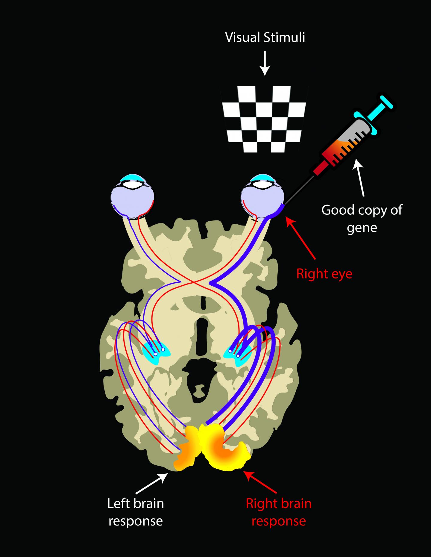 A Bilateral Disease