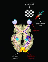 A Bilateral Disease