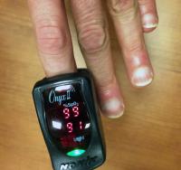 Pulse Oximeter