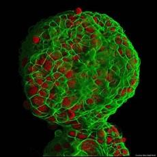 Cell Culture