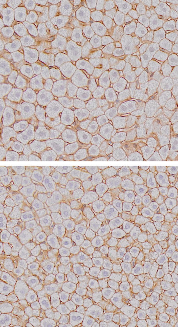 Size of the Hepatocytes