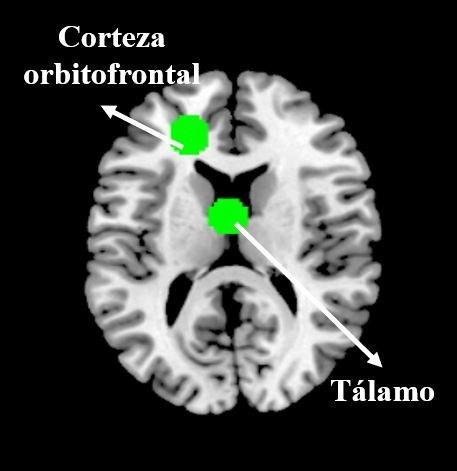 Brains of PP Voters 