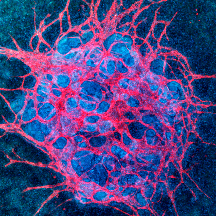 Vascularized Kidney Organoid