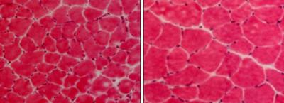 Muscle Atrophy Halted Without TWEAK