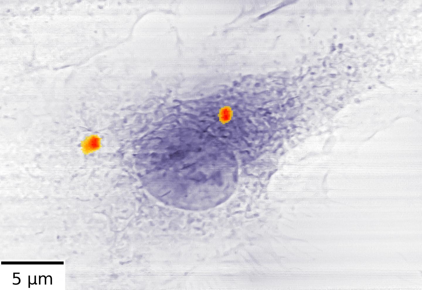 Double X-Ray Vision Helps Tuberculosis and Osteoporosis Research